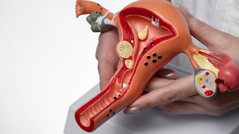 Reforma a la Salud 32 La OMS impulsa la eliminación del cáncer de cuello uterino con iniciativas globales y compromiso de los países