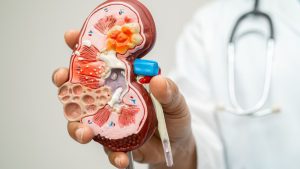 “Debemos priorizar la salud renal en las agendas de salud pública en todo el mundo”