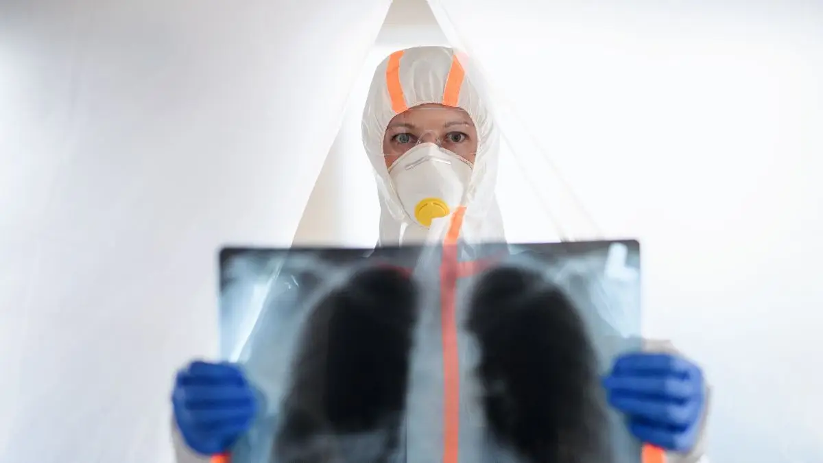¿Qué es el HMPV, el virus que está aumentando en China Lo que debes saber sobre su impacto global