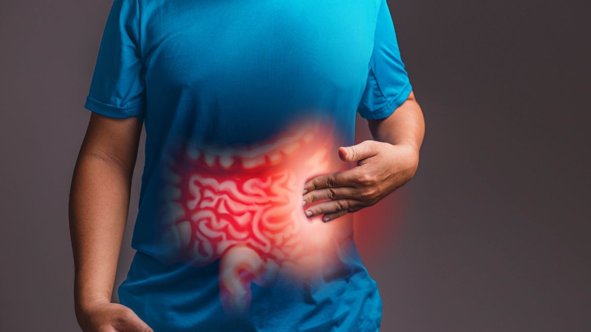 Día Mundial contra el Cáncer de Colon diagnóstico, prevención y tratamiento en Colombia