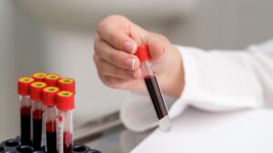 Qfitlia: La FDA aprueba el primer tratamiento de ARN para la hemofilia