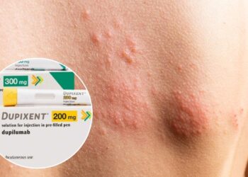 FDA aprueba Dupixent para urticaria crónica espontánea: Sanofi y Regeneron logran séptima indicación del biológico