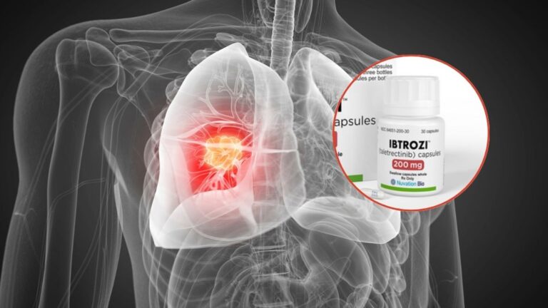 FDA aprueba Ibtrozi, el nuevo inhibidor para cáncer de pulmón con alteración ROS1
