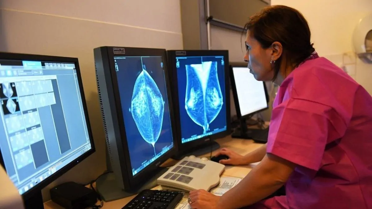 La FDA autoriza la primera plataforma de IA para predecir el cáncer de mama: nuevo horizonte para la detección personalizada
