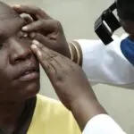 Burundi elimina el tracoma y marca un hito en la lucha contra las enfermedades tropicales desatendidas