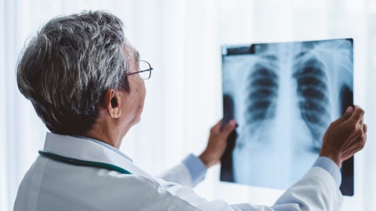 Corticosteroides e inmunoterapia una combinación con efectos adversos en pacientes con cáncer de pulmón