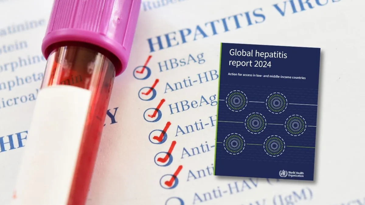 Día Mundial contra la Hepatitis: 1,3 millones de muertes anuales que aún pueden prevenirse