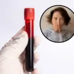 Nuevo test sanguíneo podría revolucionar el diagnóstico temprano de la esquizofrenia