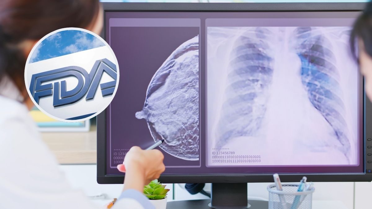 FDA aprueba innovador tratamiento oral que frena la progresión del cáncer de mama avanzado