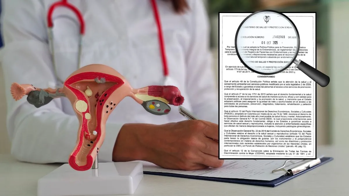 Colombia adopta la primera política pública integral para la Prevención, Diagnóstico y Tratamiento de la Endometriosis (1)