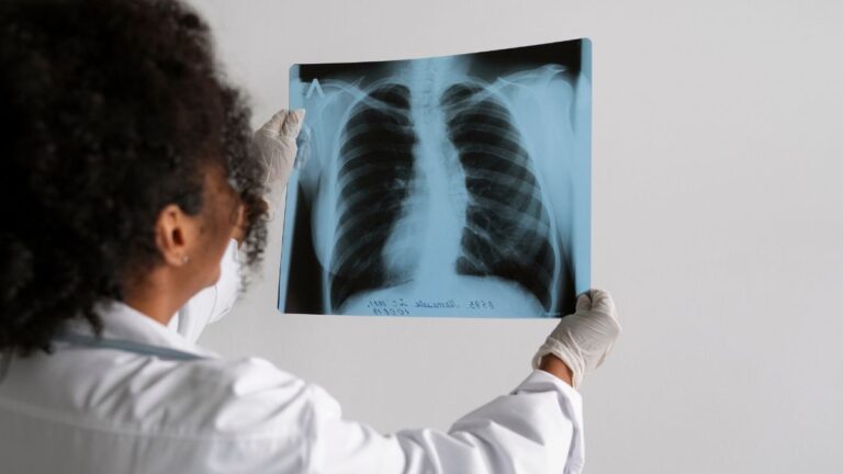 EMA recomienda la aprobación del primer tratamiento para la enfermedad pulmonar crónica BNCF