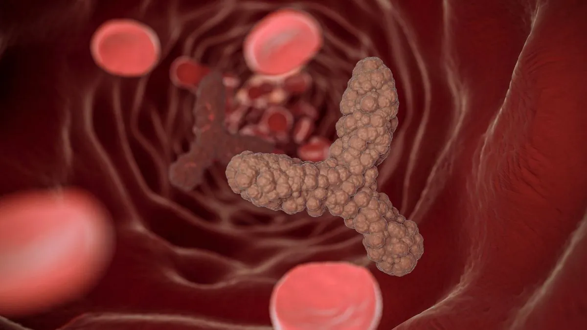 SHUA, una enfermedad ultrarrara que puede dañar órganos en horas si no se detecta a tiempo