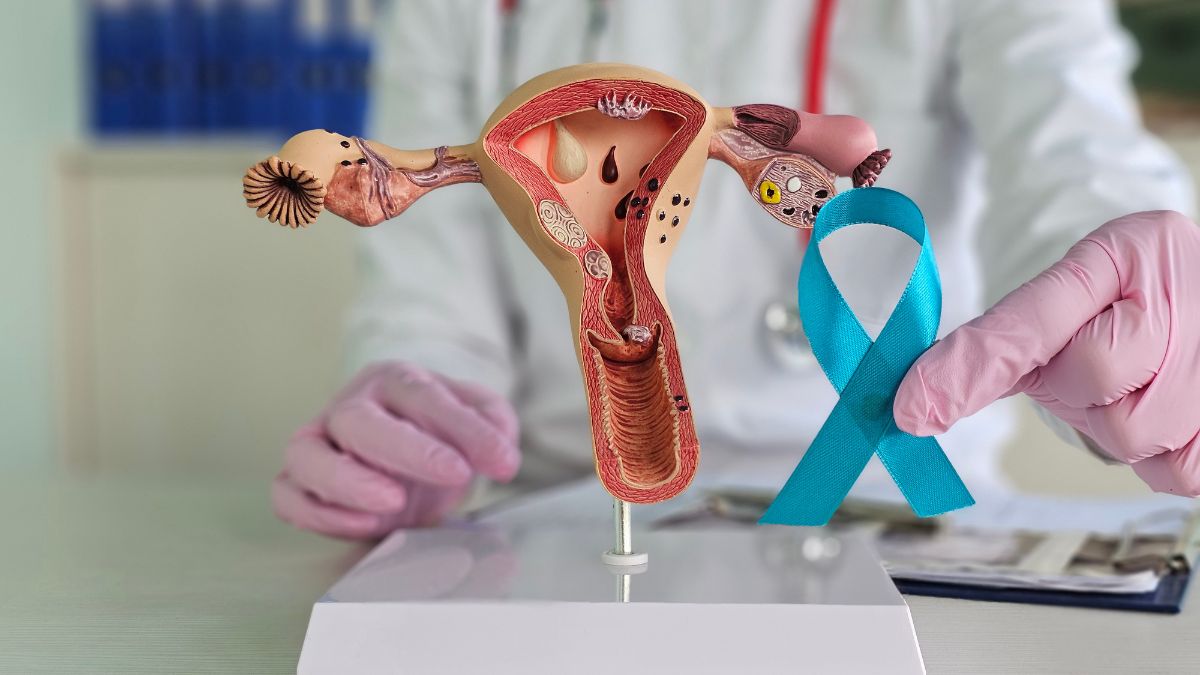 Cáncer de cuello uterino: citologías, tamización y el reto de acelerar la prevención en el Día Mundial contra el Cáncer