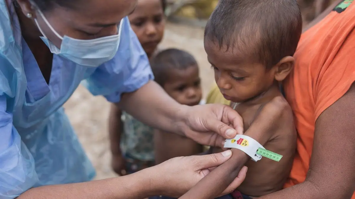 Minsalud actualiza la ruta contra la desnutrición aguda infantil