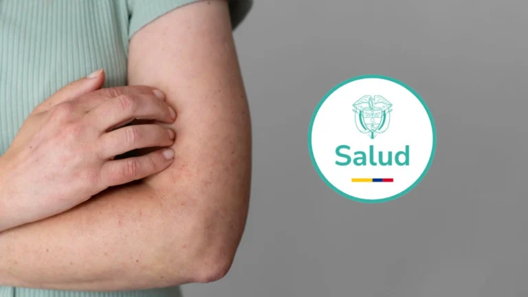 Sarampión importado en Colombia suma cinco casos confirmados y refuerza alerta por viajeros