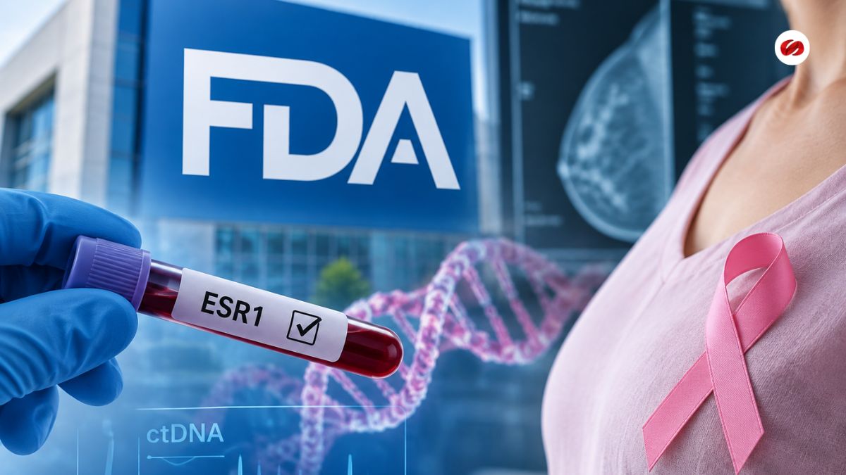 FDA aprueba nueva terapia para cáncer de mama con mutación ESR1