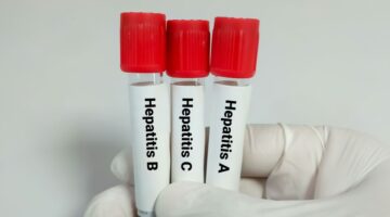 28 de julio Día Mundial contra la Hepatitis