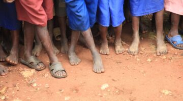 30.000 niños murieron a causa de la desatención al cáncer infantil en África