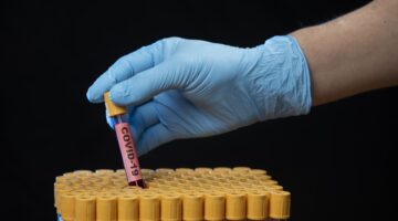 428 mil pruebas tomadas estrategia DAR