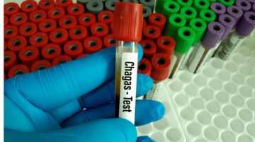 70% afectados con Chagas desconoce diagnostico