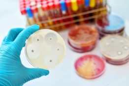 Resistencia antimicrobiana
