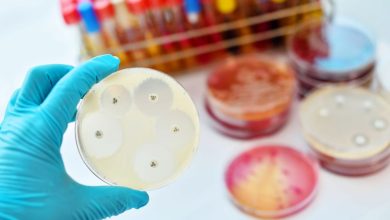 Resistencia antimicrobiana