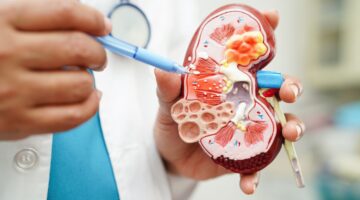 A propósito del día mundial del riñón ¿tus riñones están bien Detecta a tiempo y protege tu salud renal