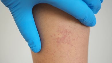 ABC sobre la púrpura trombocitopénica trombótica