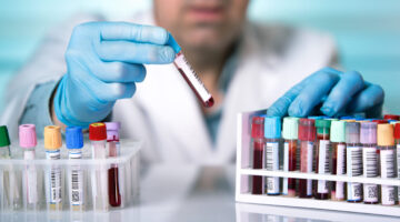 ACHO impulsa RENEHOC, una herramienta que busca promover un mejor desenlace de los casos de cáncer en sangre