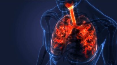 AbbVie está tras el duro mercado de la fibrosis quística