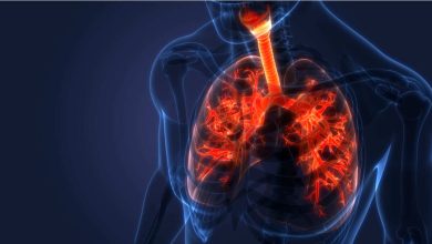 AbbVie está tras el duro mercado de la fibrosis quística