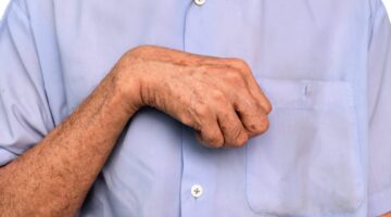 Abecé sobre espasticidad