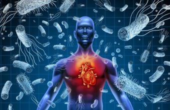 Actualizan guías de manejo para la endocarditis infecciosa
