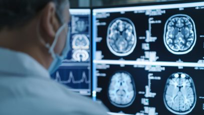 Acusan a Cassava Sciences de manipular datos en ensayos de Alzheimer