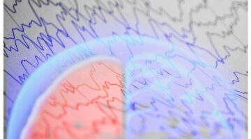 Adultos jóvenes, los más afectados por la epilepsia en Colombia