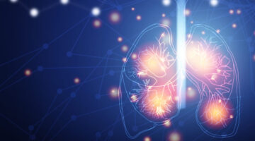 Algoritmo basado en inteligencia artificial predice el riesgo de cáncer de pulmón