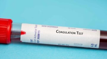 Análisis de costo-efectividad de anticoagulantes orales en pacientes con cáncer