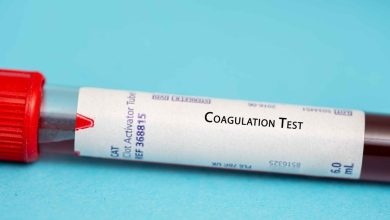 Análisis de costo-efectividad de anticoagulantes orales en pacientes con cáncer