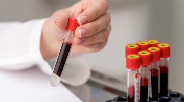 Análisis de sangre podría diagnosticar Parkinson hasta 7 años antes de los síntomas