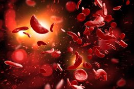 Anemia drepanocítica - La enfermedad de células falciformes
