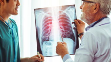 Aprueban pembrolizumab como neoadyuvante en cáncer de pulmón de células no pequeñas