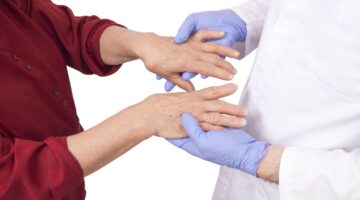 Artritis reumatoide: enfermedad que impacta a miles de colombianos