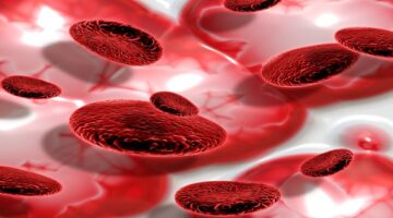 Aterosclerosis puede retrasar su progresión con ayuda de terapia hormonal