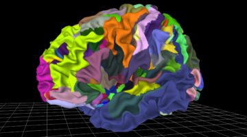 Atlas cerebral interactivo herramienta inexplorada en psiquiatría