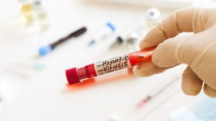 ¿Aumento de casos de hepatitis C en Argentina?: una mirada de la enfermedad en la última década