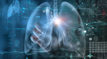 Avances en Inteligencia Artificial (IA) revolucionan el diagnóstico de tuberculosis pulmonar