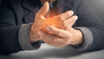 Avances en el tratamiento de la artritis reumatoide nuevas estrategias y desafíos en el manejo de la enfermedad