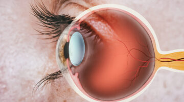 Avances en el tratamiento ocular: Aflibercept en dosis altas mantiene resultados durante 96 semanas