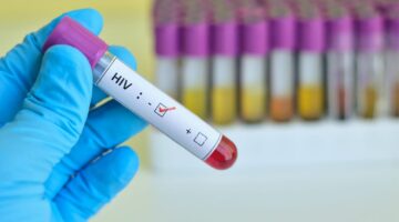 Avances en los tratamientos del VIH cuarta persona en remisión