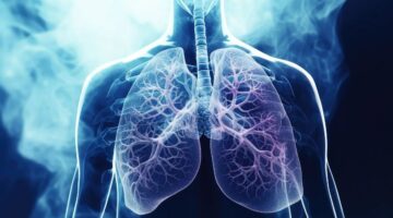 Avanzando hacia un modelo de gestión integral de las enfermedades respiratorias crónicas en Colombia